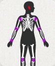 Image depicting Haemophilus influenzae type B (Hib)