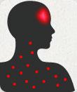 Image depicting rubella